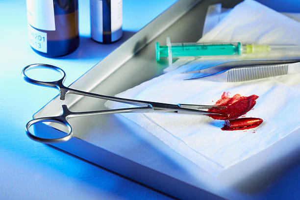 Retained Surgical Items: When Hospitals Leave Tools Inside You