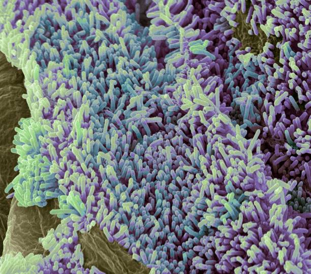 E. coli in Romaine Lettuce: Who Pays When Your Salad Makes You Sick